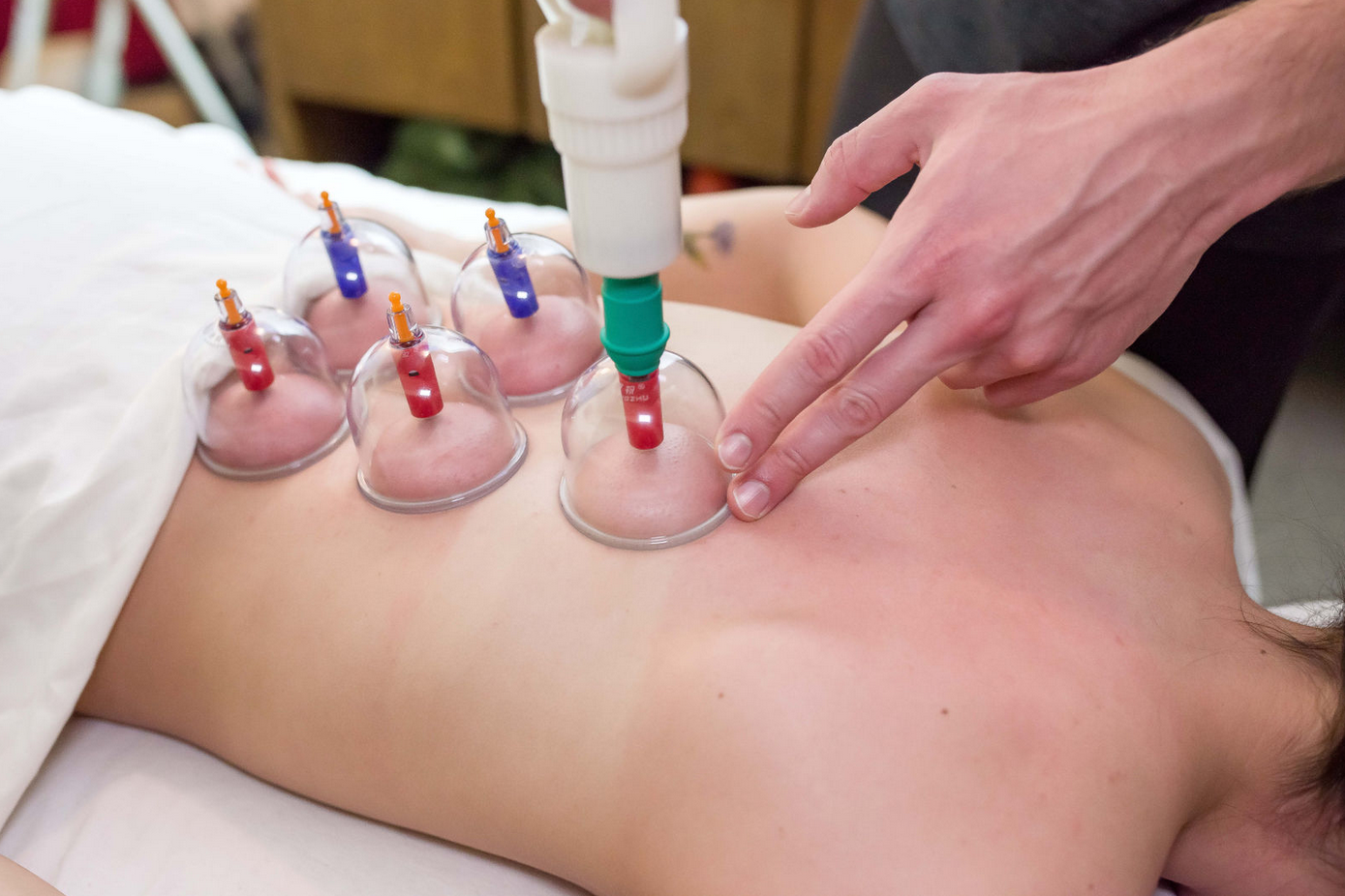 Cupping therapy during a massage or Thai bodywork at Na'masaje in Boise or Caldwell.